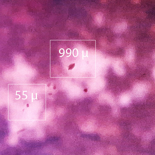 Microscopic view of Ceriodaphnia dubia, a freshwater crustacean, with size indicators for scale.